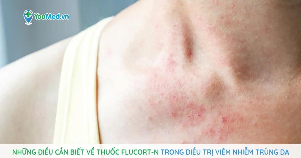 Những điều cần biết về thuốc Flucort-N trong điều trị viêm nhiễm trùng da