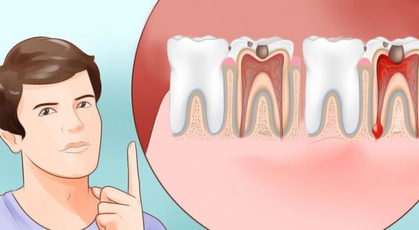 Răng đau nhức khiến bạn khó chịu