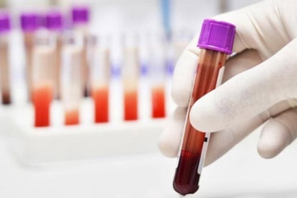 Xét nghiệm máu để chẩn đoán ngộ độc chì