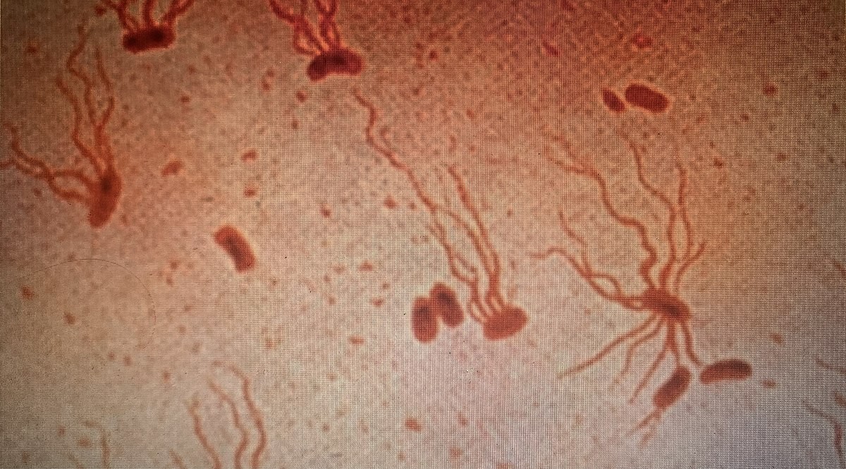 Vi khuẩn Salmonella Typhi có thể gây bệnh thương hàn