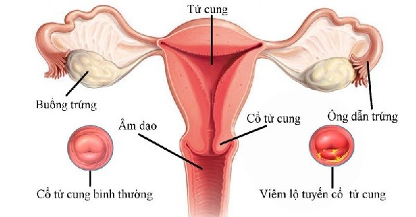 Cấu trúc khái quát của cơ quan sinh dục ở nữ