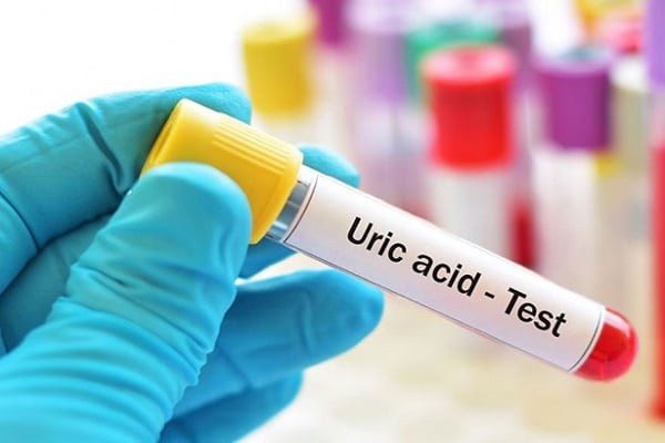 Xét nghiệm định lượng Acid uric máu