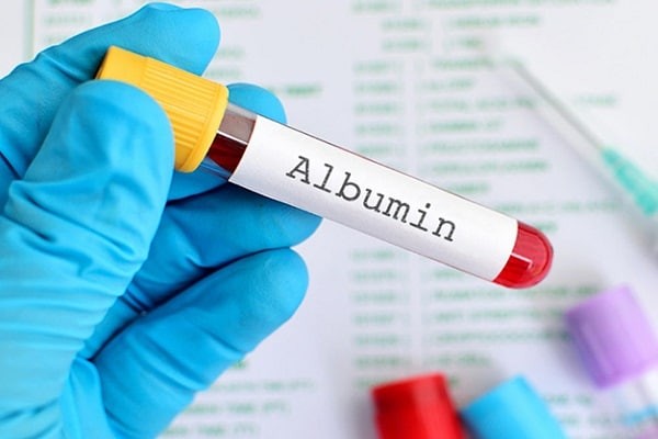 Xét nghiệm nồng độ Albumin trong máu
