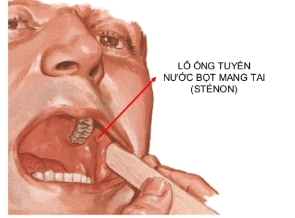 Khoang miệng: Bạn có biết rằng vấn đề về khoang miệng có thể ảnh hưởng đến sức khỏe của bạn? Xem các hình ảnh liên quan để tìm hiểu về các bệnh lý và những giải pháp đơn giản để giữ cho khoang miệng của bạn lành mạnh.