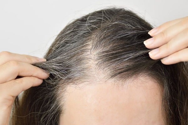 Phối hợp dược liệu Khương hoạt với các vị thuốc khác để chữa tóc bạc sớm
