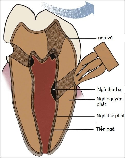 cấu trúc ngà răng