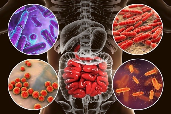 Vi khuẩn đường ruột phát triển quá mức gây nên bệnh lý