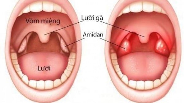 Cấu trúc khoang miệng
