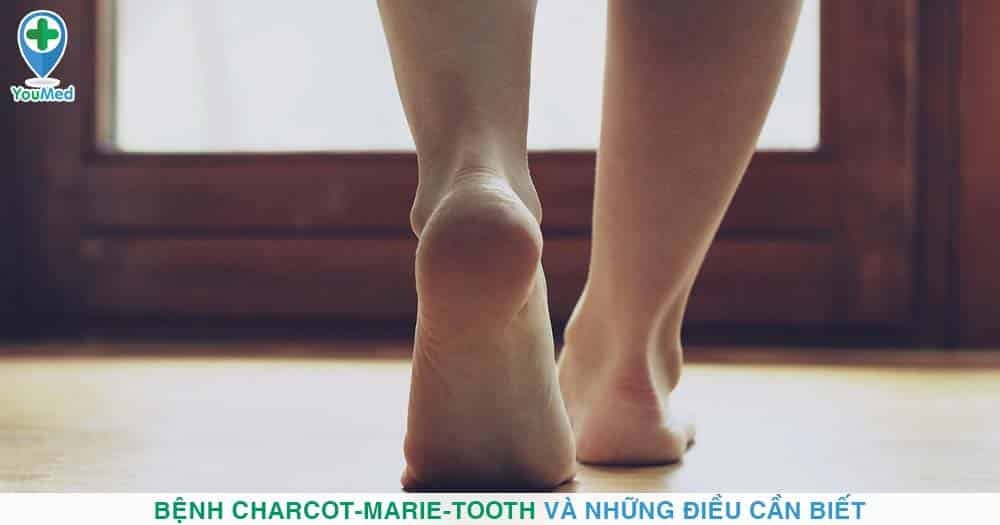 Bệnh Charcot-Marie-Tooth và những điều cần biết