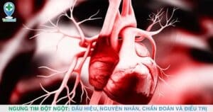 Ngưng tim đột ngột: Dấu hiệu, nguyên nhân, chẩn đoán và điều trị