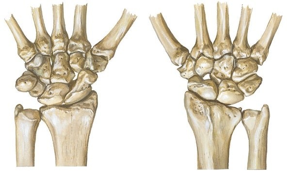 Minh họa các xương vùng cổ tay mặt gan tay và mu tay