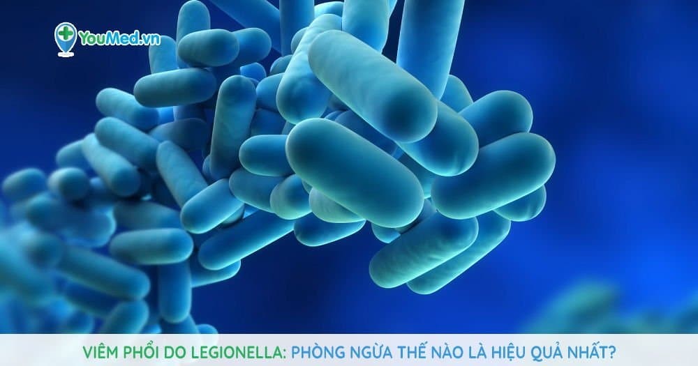 Viêm phổi do Legionella: Phòng ngừa thế nào là hiệu quả nhất?
