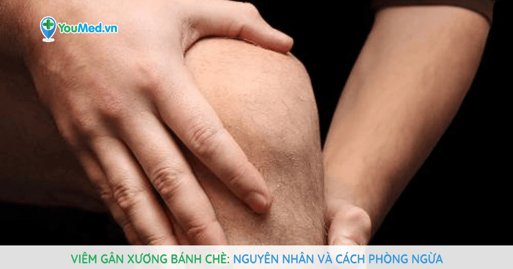 Viêm gân xương bánh chè: Nguyên nhân và cách phòng ngừa