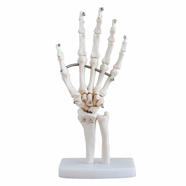 Mô hình minh họa các khối xương ở bàn tay