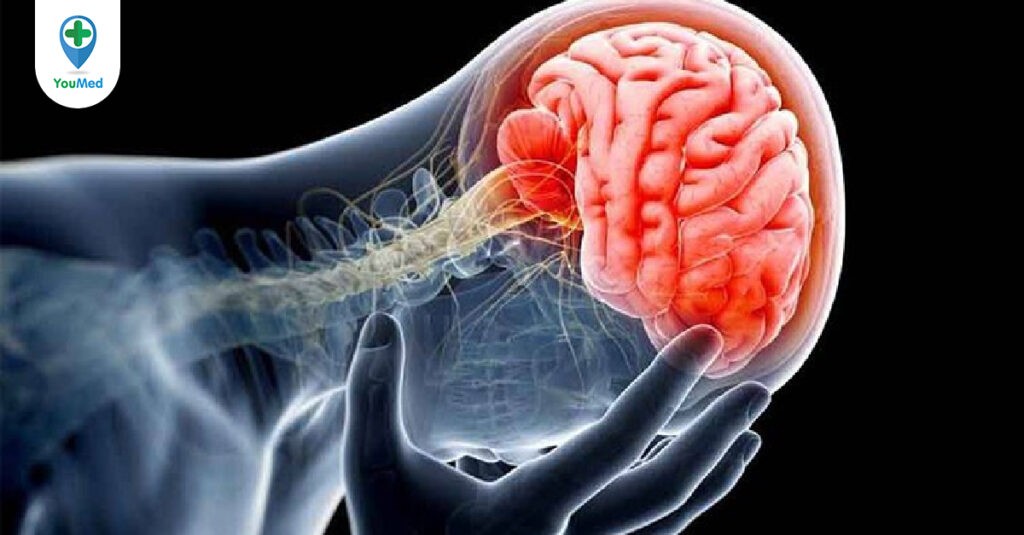 Bạn biết gì về Bệnh não chấn thương mãn tính?