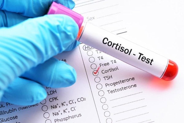 Làm xét nghiệm nồng độ cortisol