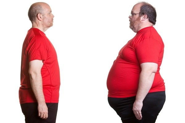 Béo phì, đặc biệt là béo bụng gây nguy cơ bị gan nhiễm mỡ