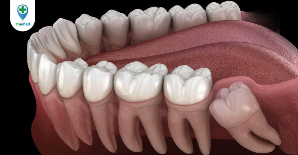 Răng cối lớn: Những thành viên “mới” của bộ răng vĩnh viễn