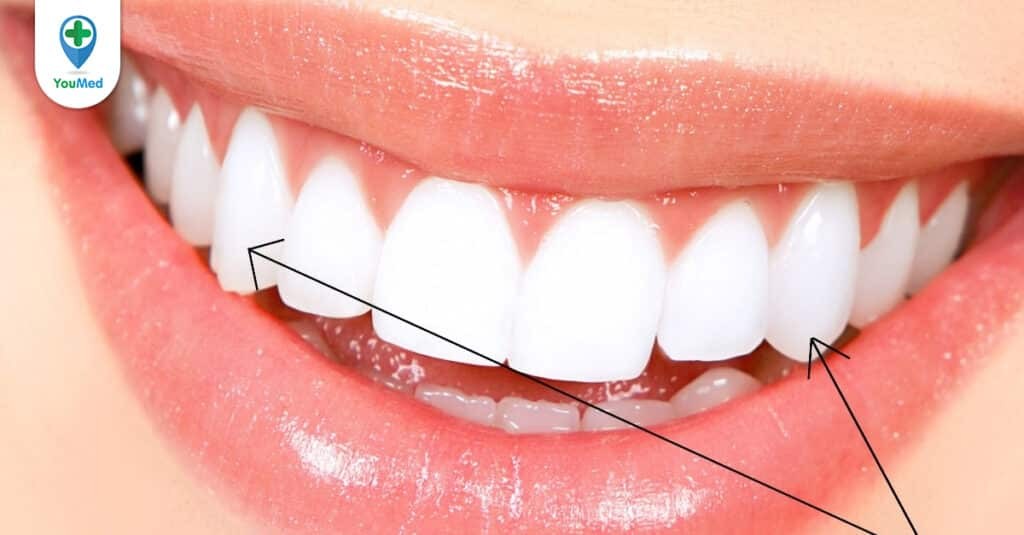 Răng nanh và các đặc điểm giải phẫu, chức năng của chúng