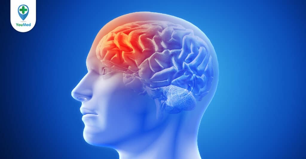 Rối loạn chức năng não sau hóa trị: Dấu hiệu, nguyên nhân và điều trị