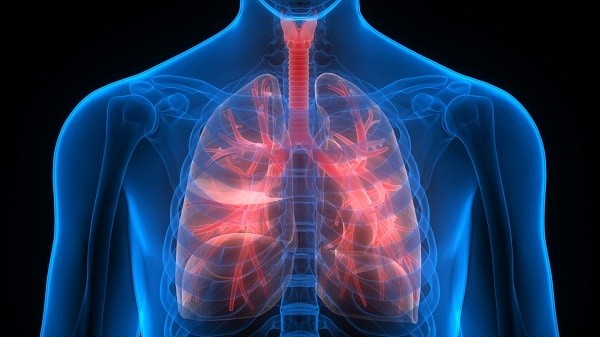 Tăng áp phổi là một biến chứng có thể gây tử vong