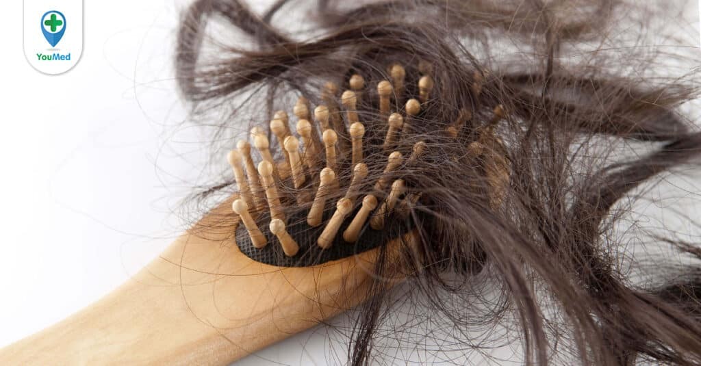 Rụng tóc sau sinh có đáng sợ như bạn nghĩ?
