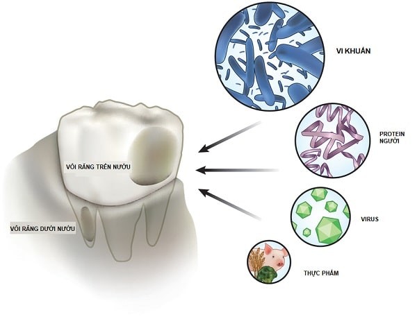 Thành phần trong mảng bám trên bề mặt vôi răng