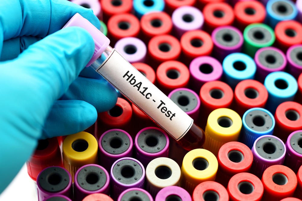 Xét nghiệm tiểu đường HbA1c là một xét nghiệm máu cho biết mức đường huyết trung bình trong 3 tháng vừa qua