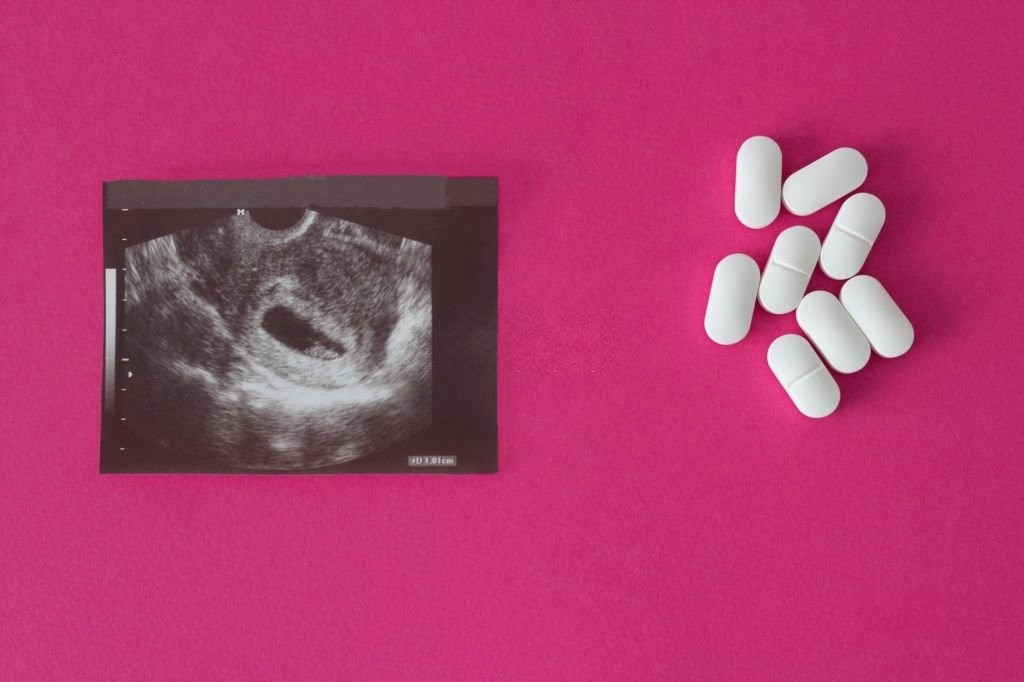 Thuốc phá thai làm ngừng quá trình phát triển của thai