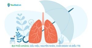 Bụi phổi amiăng: Dấu hiệu, Nguyên nhân, Chẩn đoán và Điều trị