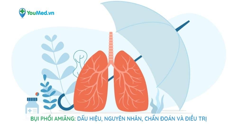 Bụi phổi amiăng: Dấu hiệu, Nguyên nhân, Chẩn đoán và Điều trị