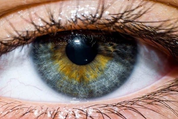 Người bị hội chứng nhốt trong có thể cử động mắt bình thường
