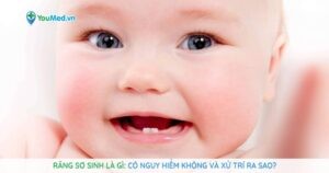 Răng sơ sinh là gì: Có nguy hiểm không và xử trí ra sao?