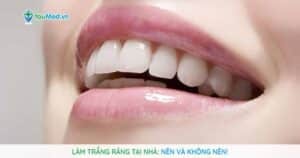 Các phương pháp làm trắng răng tại nhà: Nên và không nên!