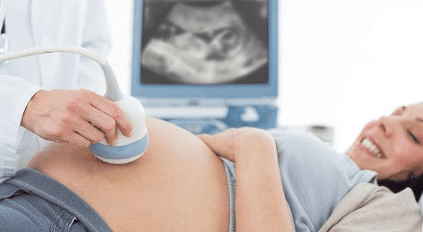Dây rốn quấn cổ có thể chẩn đoán được trong giai đoạn thai kỳ