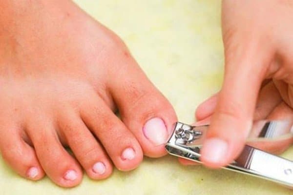 Hãy vệ sinh và cắt móng chân thường xuyên