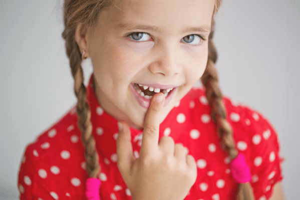 răng lung lay ở trẻ