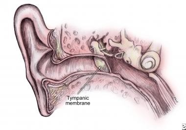 Màng nhĩ: bộ phận quan trọng trong tai người