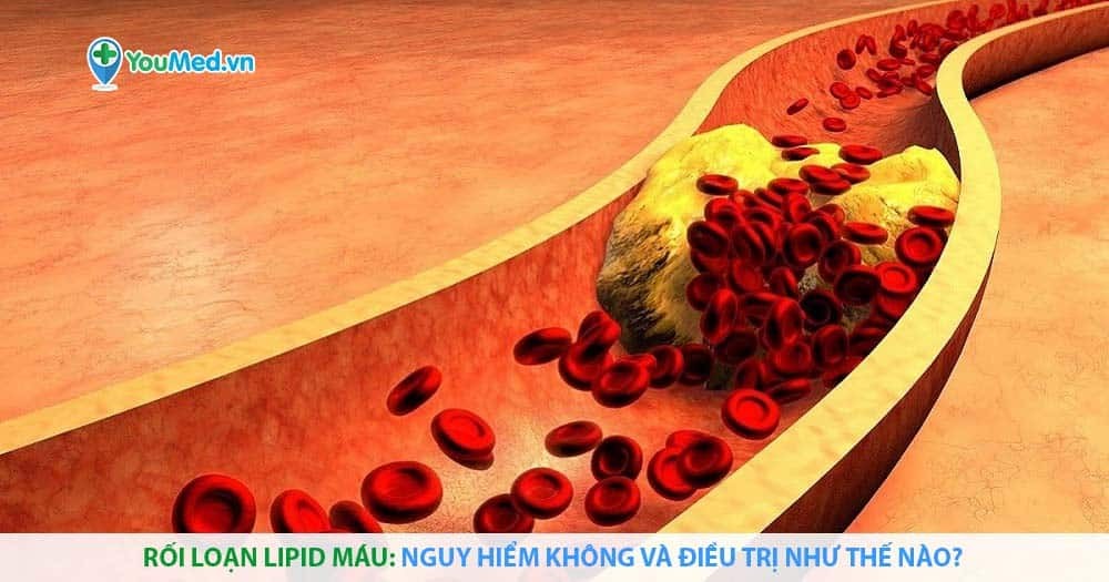 Rối loạn lipid máu: nguy hiểm không và điều trị như thế nào?