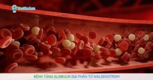 Bệnh tăng Globulin đại phân tử Waldenstrom