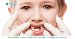 Răng ố vàng đổi màu ở trẻ: nguyên nhân, điều trị và phòng ngừa