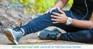 Viêm bao hoạt dịch khớp: Làm gì để cải thiện đau sưng tại nhà?