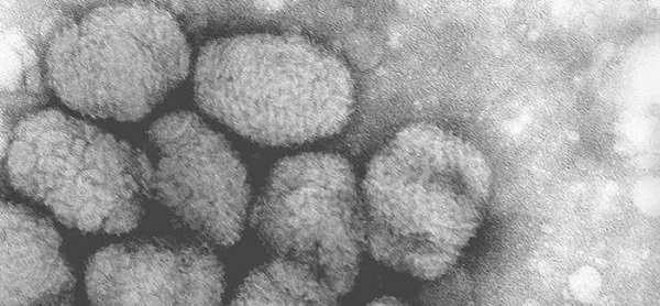 Bệnh đậu mùa là một bệnh truyền nhiễm nghiêm trọng do vi rút variola gây ra