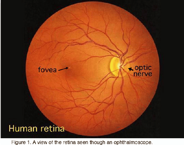 Fovea: Hoàng thể. Optic nerve: Thần kinh thị giác. Human retina: Võng mạc người. Hình ảnh võng mạc qua đèn soi đáy mắt.