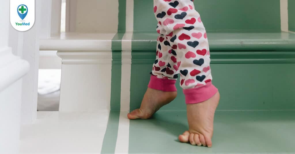 Tật đi nhón chân ở trẻ em liệu có cần phải điều trị?