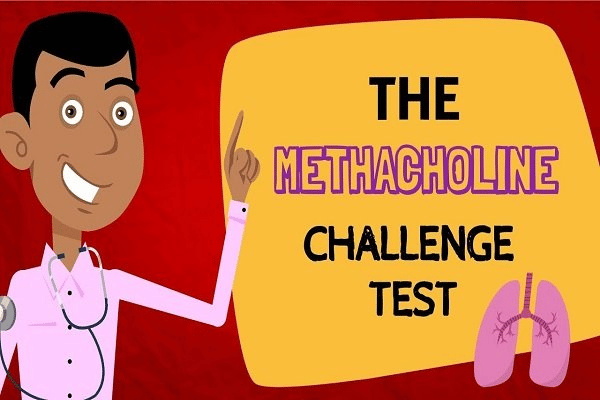  Methacholine test