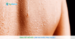 Những biện pháp khắc phục tăng tiết mồ hôi hiệu quả