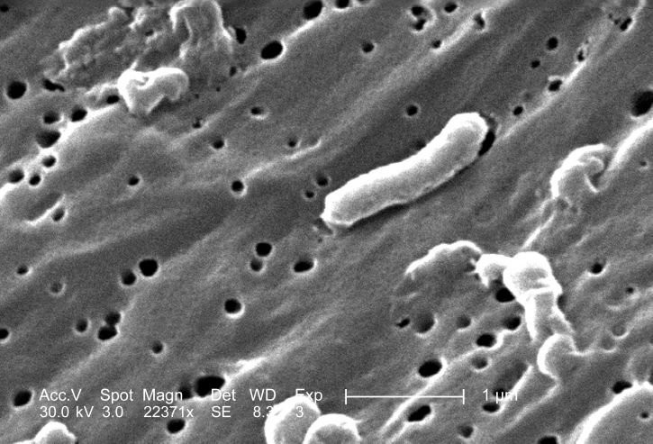 Vi khuẩn Vibrio cholerae dưới kính hiển vi