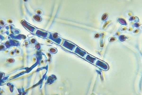  Xét nghiệm tìm vi nấm gây bệnh