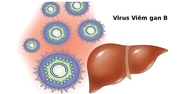 Virus viêm gan B là một trong những nguyên nhân gây suy gan cấp
